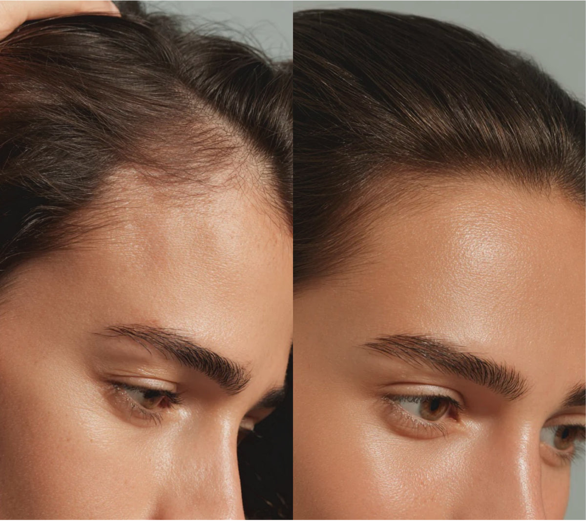 Duo vaste shampoo anti-haaruitval en conditioner Homnès, weergave 2