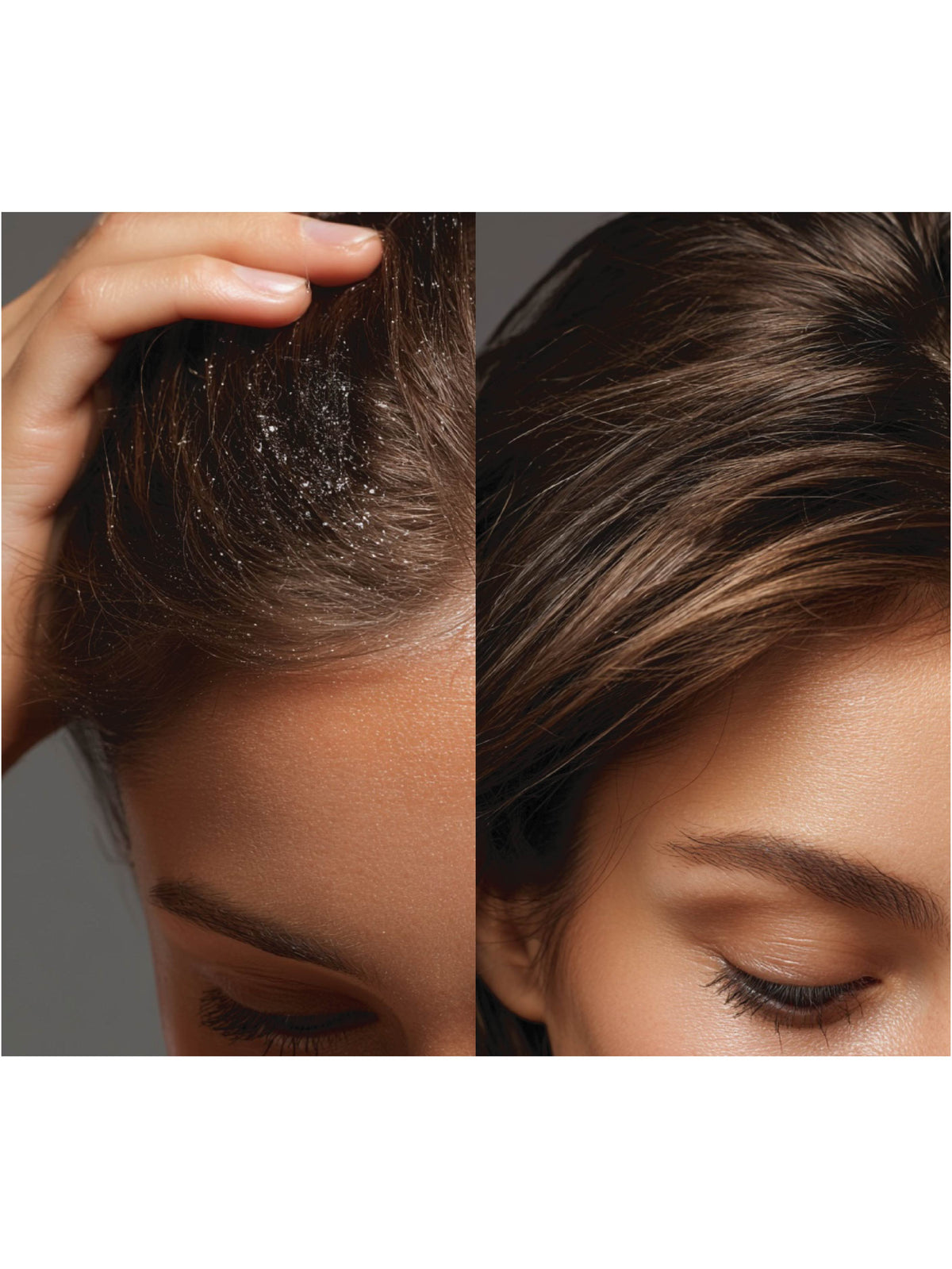 Détail texture du shampoing solide anti-pelliculaire Homnès