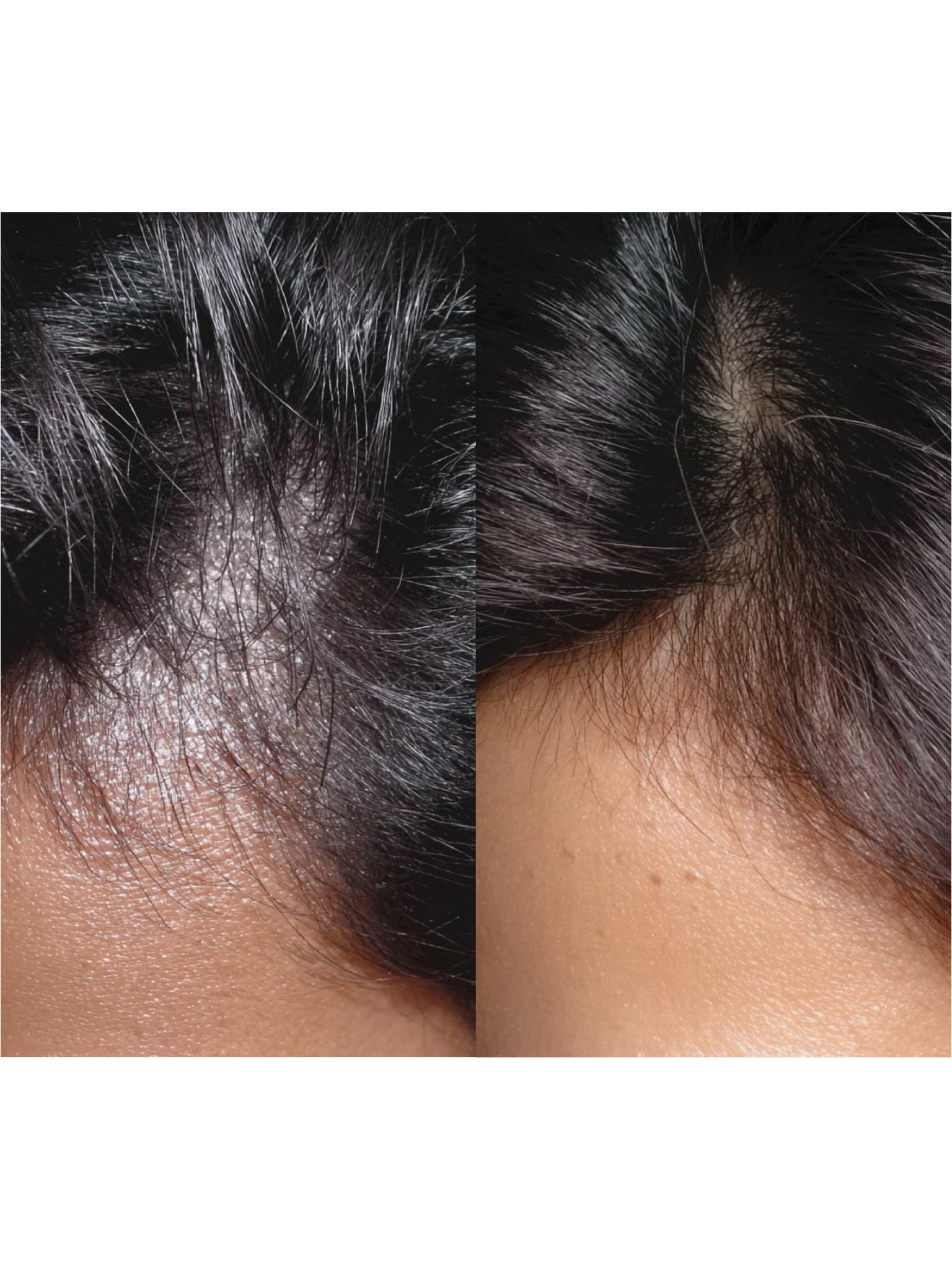 Shampoing Purifiant