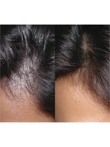 Shampoing Purifiant