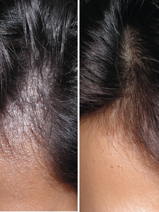 Shampoing Purifiant